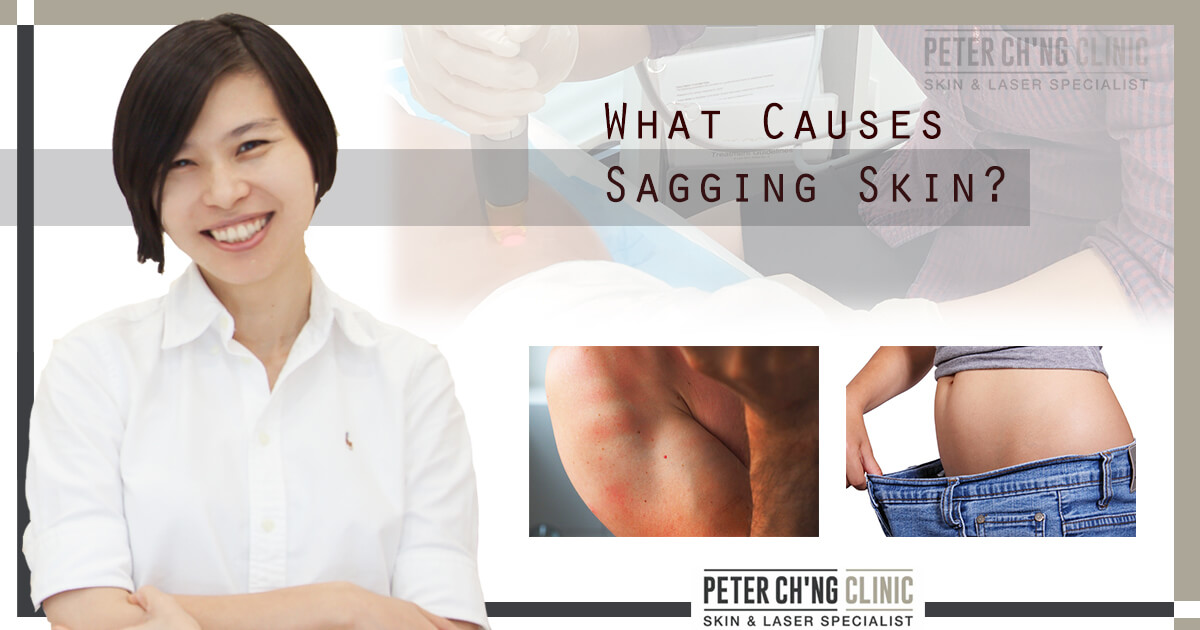 What Actually Causes Your Flabby Arms Peter Ch ng Skin